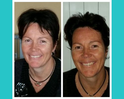 après une séance de lifting facial
luminosité et fraicheur retrouvée