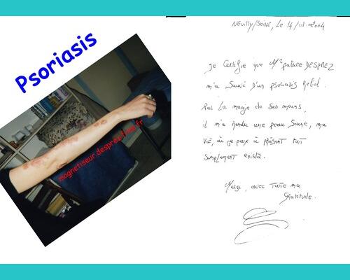 Témoignage psoriasis vaincu (2004)