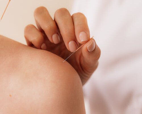 Acupuncture oculaire